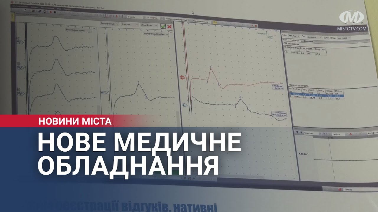 Нове медичне обладнання