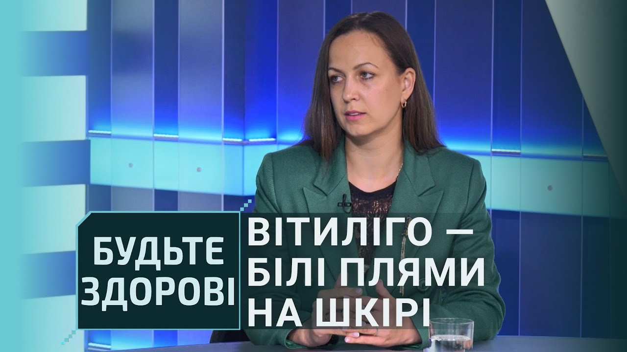 Будьте здорові!: Вітиліго — білі плями на шкірі